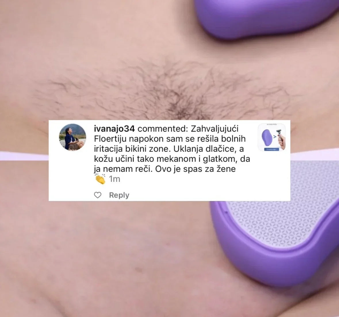 Floerty Nano Crystal Epilator