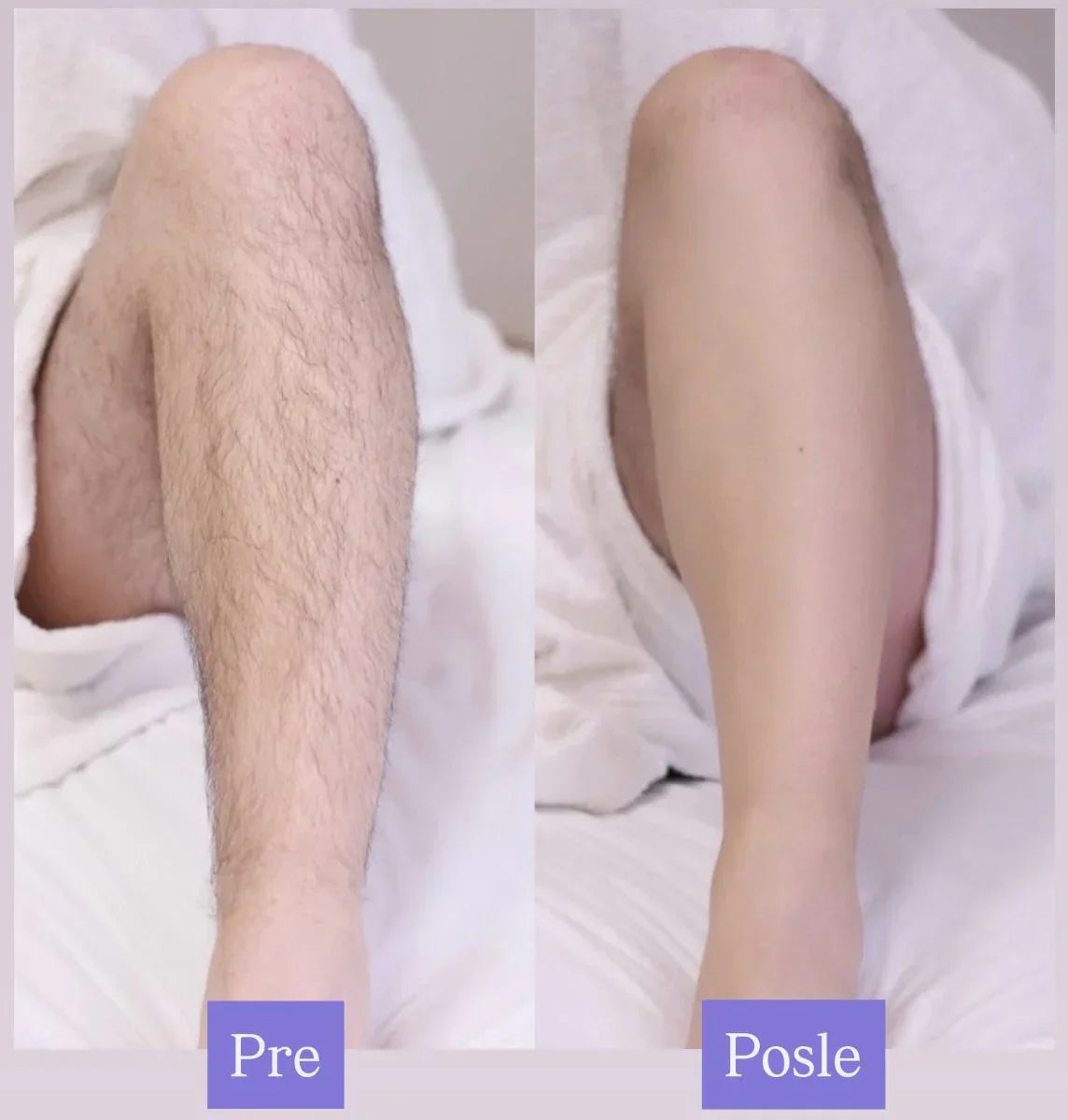 Floerty Nano Crystal Epilator
